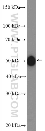 [20745-1-AP-20UL] LHX3 Polyclonal antibody