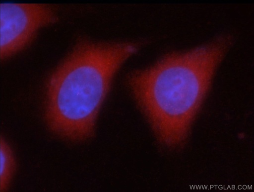 [20746-1-AP-20UL] GAD65 Polyclonal antibody