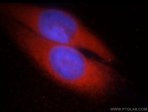 [20747-1-AP-20UL] CHAT Polyclonal antibody