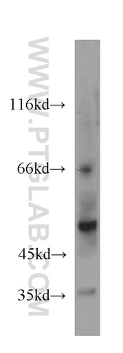 [20751-1-AP-20UL] NPT1 Polyclonal antibody