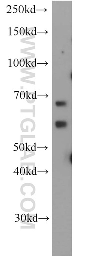 [20753-1-AP-150UL] ALG6 Polyclonal antibody
