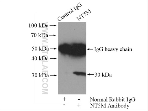 [20765-1-AP-20UL] NT5M Polyclonal antibody