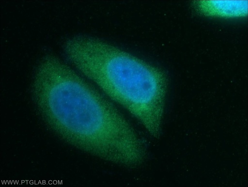 [20766-1-AP-150UL] CAPRIN2 Polyclonal antibody