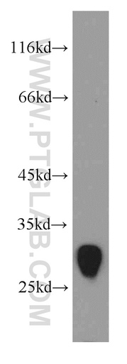 [20768-1-AP-150UL] TMEM41A Polyclonal antibody