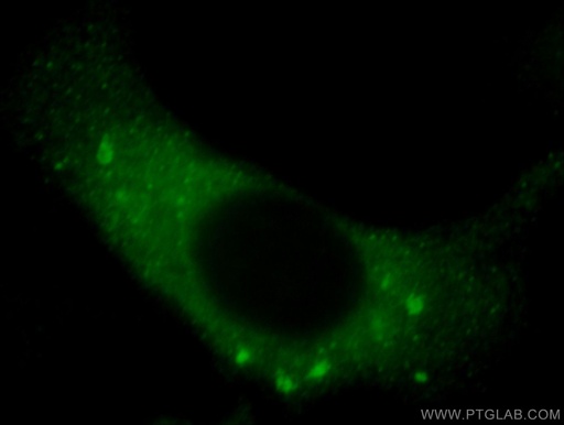 [20771-1-AP-150UL] VIPAS39 Polyclonal antibody