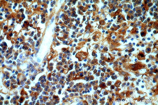 [20773-1-AP-20UL] Serum amyloid P component Polyclonal antibody