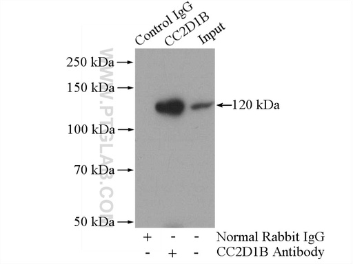 [20774-1-AP-150UL] CC2D1B Polyclonal antibody