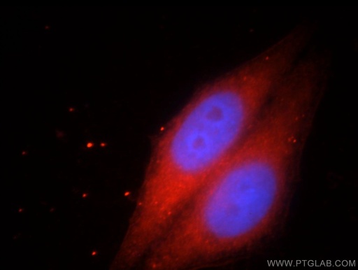 [20777-1-AP-20UL] HPDL Polyclonal antibody