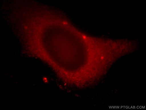 [20778-1-AP-20UL] WDR24 Polyclonal antibody