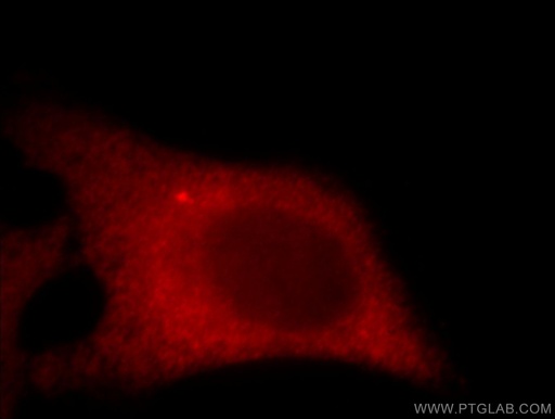 [20780-1-AP-150UL] C11orf70 Polyclonal antibody