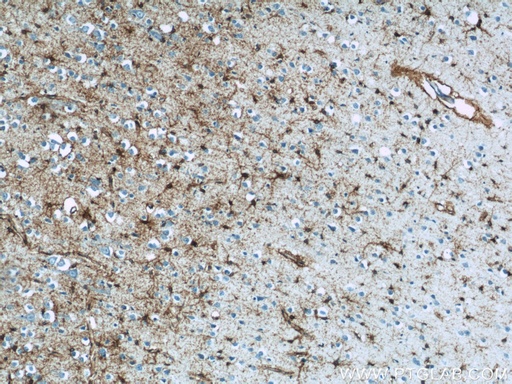 [20785-1-AP-150UL] GLAST Polyclonal antibody