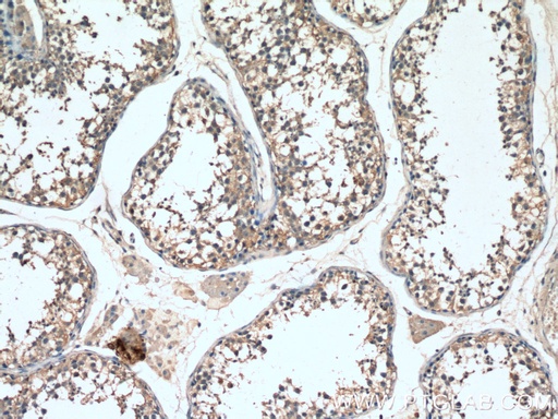 [20787-1-AP-20UL] SMO Polyclonal antibody