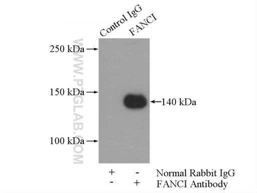 [20789-1-AP-150UL] FANCI Polyclonal antibody