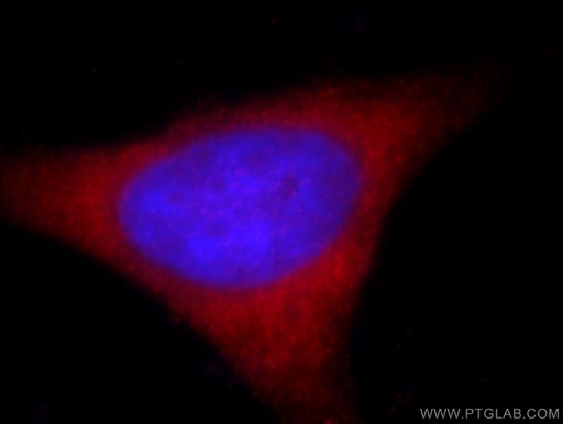 [20790-1-AP-20UL] KIFC1 Polyclonal antibody