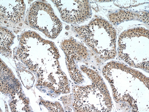 [20794-1-AP-20UL] ZNF346 Polyclonal antibody