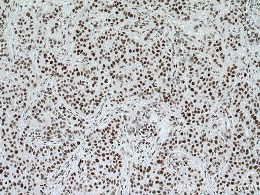 [20798-1-AP-20UL] NUP50 Polyclonal antibody
