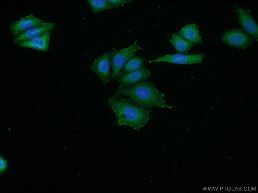 [20801-1-AP-150UL] C16orf13 Polyclonal antibody