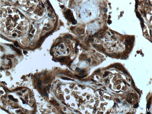 [20802-1-AP-20UL] SPRYD5 Polyclonal antibody