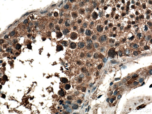 [20803-1-AP-150UL] CLASP1 Polyclonal antibody