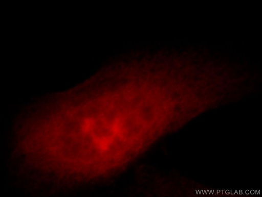 [20804-1-AP-20UL] ZNF622 Polyclonal antibody
