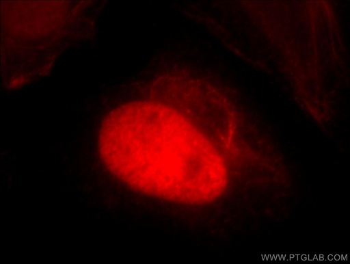 [20805-1-AP-150UL] HTATSF1 Polyclonal antibody
