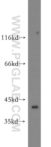 [20806-1-AP-20UL] ZNF385D Polyclonal antibody