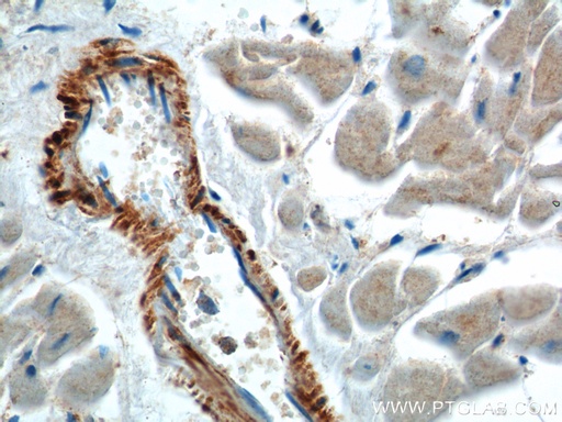 [20807-1-AP-150UL] neuron navigator 1 Polyclonal antibody