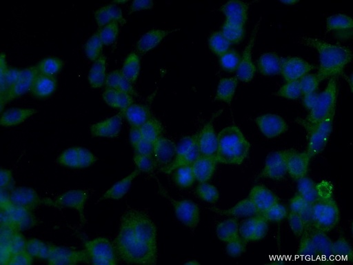 [20814-1-AP-150UL] SHD Polyclonal antibody