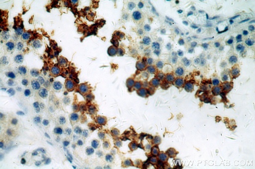 [20828-1-AP-20UL] GLIPR1L1 Polyclonal antibody