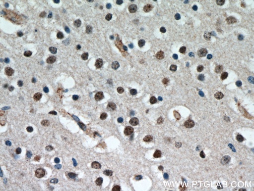 [20833-1-AP-150UL] CCDC42 Polyclonal antibody
