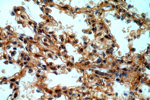 [20837-1-AP-150UL] CXorf22 Polyclonal antibody
