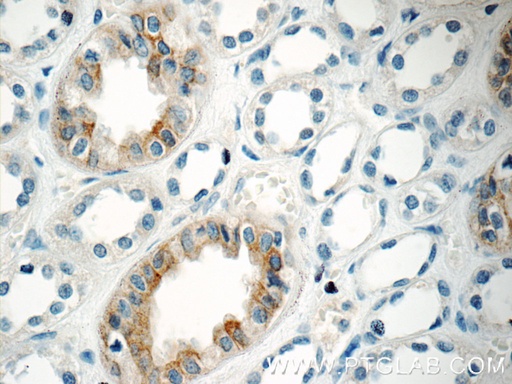 [20847-1-AP-20UL] GPR3 Polyclonal antibody