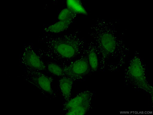 [20849-1-AP-150UL] DAX-1 Polyclonal antibody
