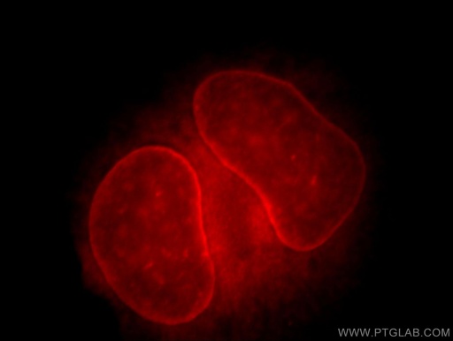 [20853-1-AP-20UL] THAP2 Polyclonal antibody
