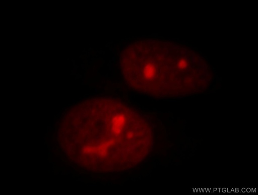 [20854-1-AP-150UL] NSUN2 Polyclonal antibody