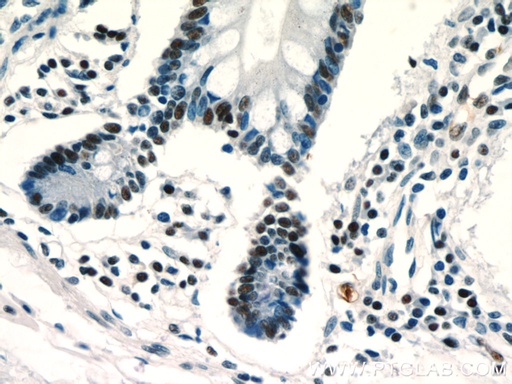 [20855-1-AP-20UL] ZSCAN20 Polyclonal antibody