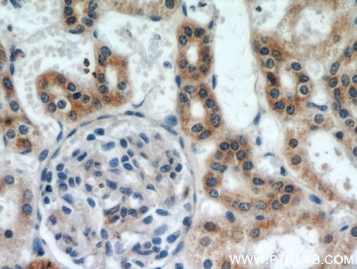 [20857-1-AP-20UL] SLC38A4 Polyclonal antibody