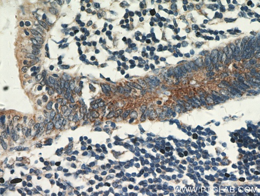 [20861-1-AP-150UL] CCDC93 Polyclonal antibody