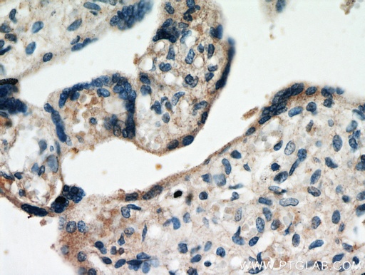 [20863-1-AP-20UL] FAM76A Polyclonal antibody