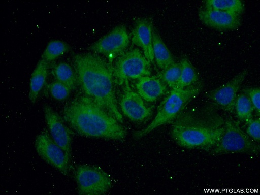 [20865-1-AP-20UL] TFPI Polyclonal antibody