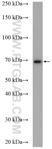 [20868-1-AP-20UL] CALCR Polyclonal antibody