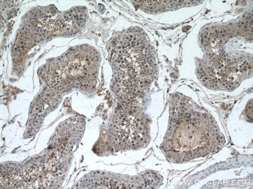[20869-1-AP-20UL] RHBDD1 Polyclonal antibody