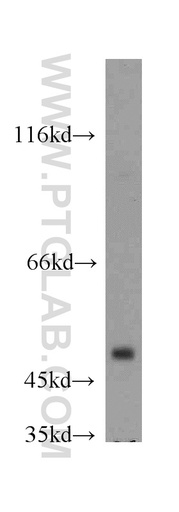 [20870-1-AP-20UL] GABPB2 Polyclonal antibody