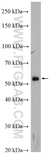 [20873-1-AP-150UL] VMAT2 Polyclonal antibody