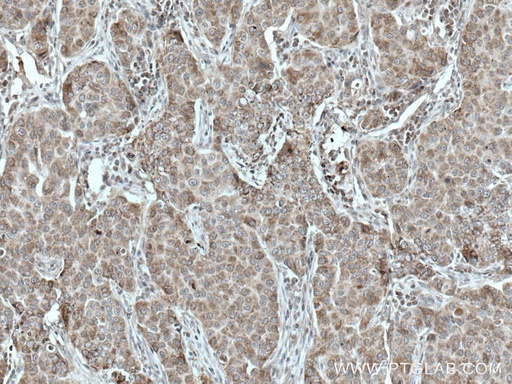 [20875-1-AP-150UL] TTC19 Polyclonal antibody