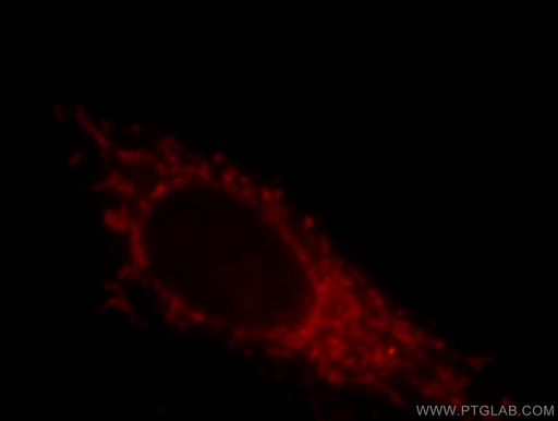 [20878-1-AP-150UL] LZTS1 Polyclonal antibody