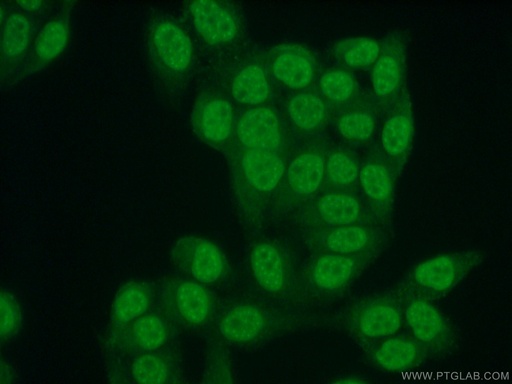 [20882-1-AP-20UL] CUL4B Polyclonal antibody