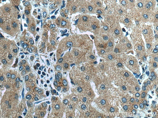 [20886-1-AP-150UL] AIFM2/ FSP1 Polyclonal antibody