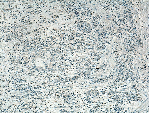 [20889-1-AP-20UL] SLC16A4 Polyclonal antibody