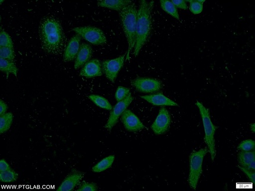 [20892-1-AP-20UL] SEC23IP Polyclonal antibody